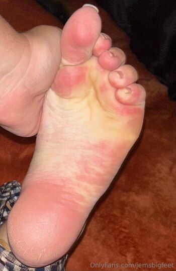 jemsbigfeet