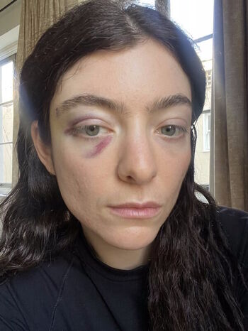 Full leaked Lorde  page private onlyfans photo